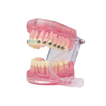 Стоматологичен ортодонтическая модел на зъбите с брекетами Стоматологичен модел на зъбите Модели на студентите-стоматолози С прозрачен самолигирующимся заключващ механизъм